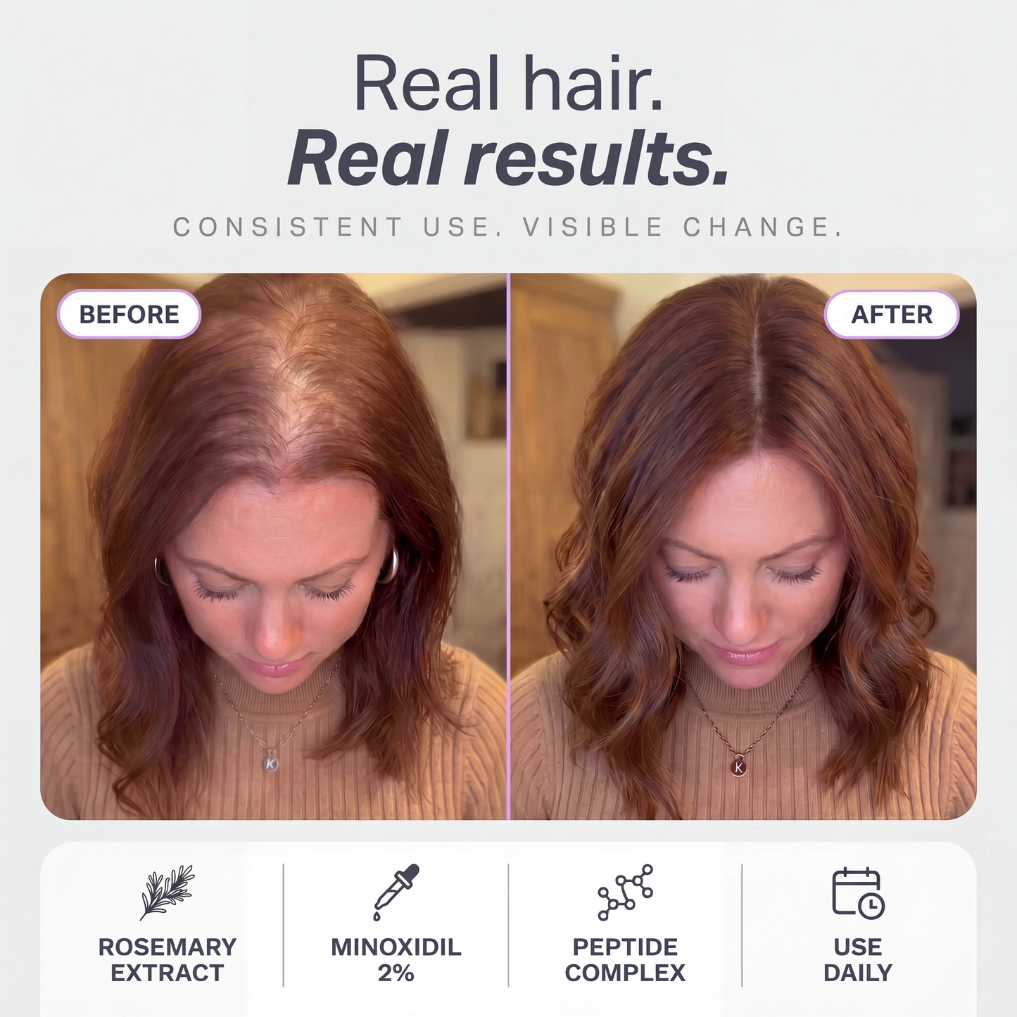 Hair Growth Serum